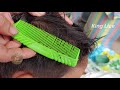 this boy full of giant lice on head lice combing