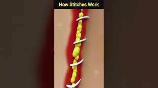 How Wound Stitches Really Work Shorts Facts Creativelearning3d