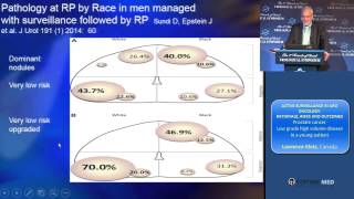 Prostate cancer: Low grade high volume disease in a young patient