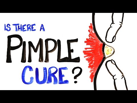 Is There A Pimple Cure? Is There A Pimple Cure?