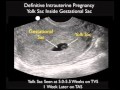 How to: OB Ultrasound - Normal Pregnancy Case Study How to: OB Ultrasound - Normal Pregnancy Case Study