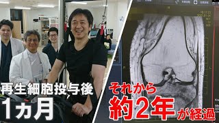 【再生医療】再生細胞『ステミラック注』投与前後で車いす歴18年の身体はどれだけ変化したのか？