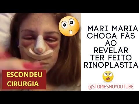 Mari Maria Surpreende Seguidores Ao Mostrar Rinoplastia - YouTube