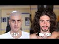 Two years time lapse of hair growth