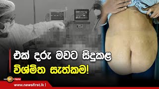 එක් දරු මවට සිදුකළ විශ්මිත සැත්කම!