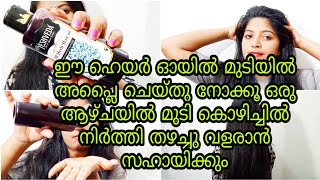 ഈ ഹെയർ ഓയിൽ മുടിയിൽ അപ്ലൈ ചെയ്തു നോക്കൂ ഒരു ആഴ്ചയിൽ മുടി കൊഴിച്ചിൽ നിർത്തി തഴച്ചു വളരാൻ സഹായിക്കും