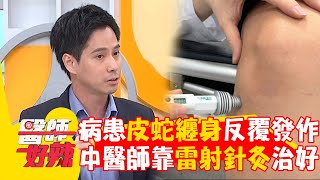 病患「皮蛇」纏身反覆發作！中醫師靠「雷射針灸」改善他神經痛？！【#醫師好辣】20240921 EP1667 part2