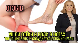 Как избавиться от боли в ногах? От сосудистой сетки и торчащих вен?Отзыв о товарах Siberian Wellness