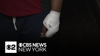 Victim of NYC subway station shooting speaks exclusively to CBS New York