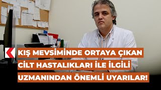 Kış mevsiminde ortaya çıkan cilt hastalıkları ile ilgili uzmanından önemli uyarılar!