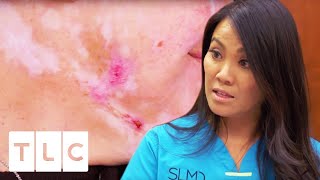 Woman With Mysterious Skin Condition Refuses To Believe Diagnosis | Dr. Pimple Popper