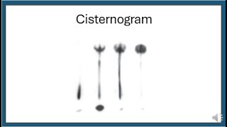 Cisternography Shunt Patency And Csf Leak Studies