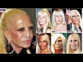 Top 10 Celebrities with TERRIBLE Plastic Surgery