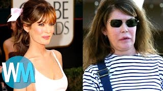 Top 10 Celebrities with TERRIBLE Plastic Surgery