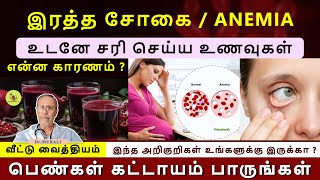 ANEMIA - CAUSES, SYMPTOMS, FOODS TO INCREASE IRON IN TAMIL. HOME REMEDIES .