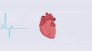 Duchenne Care Video 5: Cardiac Devices