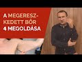 A megereszkedett bőr 4 megoldása