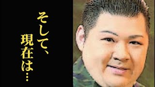 大江裕を突然襲った病とその後の変化に驚きを隠せない…