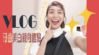 ｜KAILI'S VLOG｜牙齒貼片親身體驗全記錄