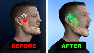 The Revolutionary New Fix For TMJ \u0026 Jaw Pain