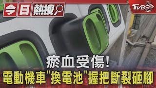 瘀血受傷! 電動機車「換電池」握把斷裂砸腳｜TVBS新聞 @TVBSNEWS01