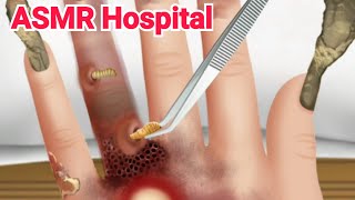 ASMR | Maggot Infested Finger Removal | Severely Injured Animation