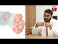 நரம்பு தளர்ச்சி இதெல்லாம் தெரியவே தெரியாதே சார் 😱 nerve disorders doctor explains positivitea