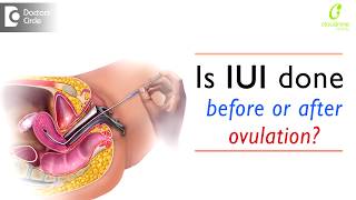 Is IUI done before or after ovulation? | Infertility Treatment - Dr. Uma Maheshwari of C9 Hospitals