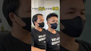 不剃光头也可以戴假发 #假发 #假发补发 #剪发前vs剪发后 #男士假发