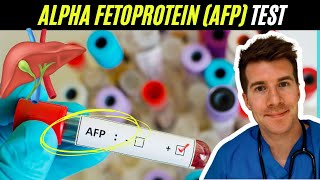 Doctor explains Alpha Fetoprotein (AFP) blood test | Liver and testicular cancer