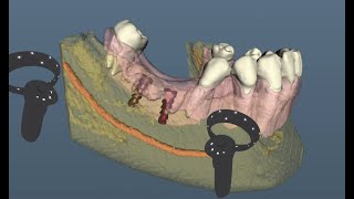 Virtual Reality tech demo of Dent.AI 3D Guide