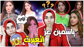 ياسمين عز قبل التجميل وبعد التجميل شاهد رد فعلها | شكلها اتغير ازاي ؟