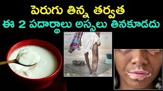 పెరుగు తిన్న తర్వత ఈ 2 పదార్థాలు అస్సలు తినకూడదు || Perugu thinna tharavata em thinakudadhu || curd