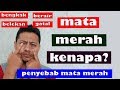 Penyebab Mata Merah || Penyebab sakit mata merah, bengkak, berair,gatal dan belekan ,