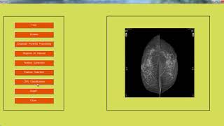 Digital Image Processing Projects List | Digital Image Processing Thesis List