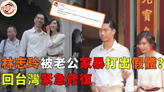 秘密藏不住？曝林志玲被老公家暴致假體飛出，緊急回台做修復手術，黑澤良平真實形象大跌眼鏡 #林志玲 #娱乐矿工 #黑澤良平 #akira