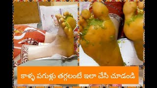 కాళ్ళ పగుళ్లు తగ్గాలంటే ఇలా చేయండి | Simple Home Remedy For CRACKED Legs