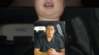 GONDONGAN/ MUMPS #youtubehealth #youtubehealthindonesia