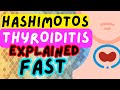 Hashimoto Thyroiditis - EXPLAINED IN 2 MINUTES! (Autoimmune Hypothyroid)