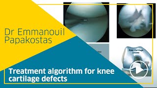 Treatment algorithm for knee cartilage defects, Dr Emmanouil Papakostas