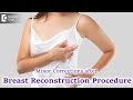 Can Minor Corrections be done after Breast Reconstruction? - Dr. Srikanth. V | Doctors' Circle