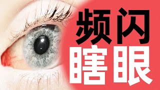 你知道频闪如何伤害你的眼睛吗？「氪绅科技」