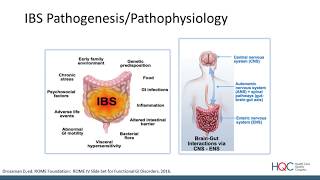 IBS-D: Therapeutic Advances and the Impact of the Gut Microbiome