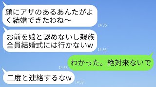 生まれつき顔にアザがある私を見下して、母親が結婚式を欠席した親族たち。「お前は娘じゃない」と言われたが、数時間後に毒母が式に来てほしいと頼んできた理由がwww。