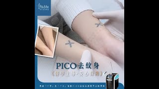 【去紋身，保形象！PicoSure去紋身神器】醫學主導，安心保障