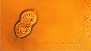 Dividing HeLa cancer cell, Timelapse Medical