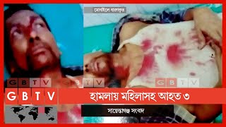 শায়েস্তাগঞ্জে প্রতিপক্ষের হামলায় মহিলা সহ আহত ৩ || শায়েস্তাগঞ্জ খবর || Shayestaganj News || gb tv