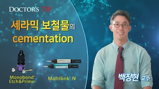 [Multilink N] 세라믹 보철물의 cementation