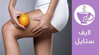 أسباب ونصائح لعلاج السليوليت | Cellulite Causes and Treatments | لايف ستايل