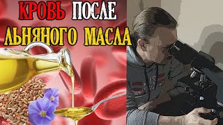 Кровь после льняного масла ➕ бонус салат...